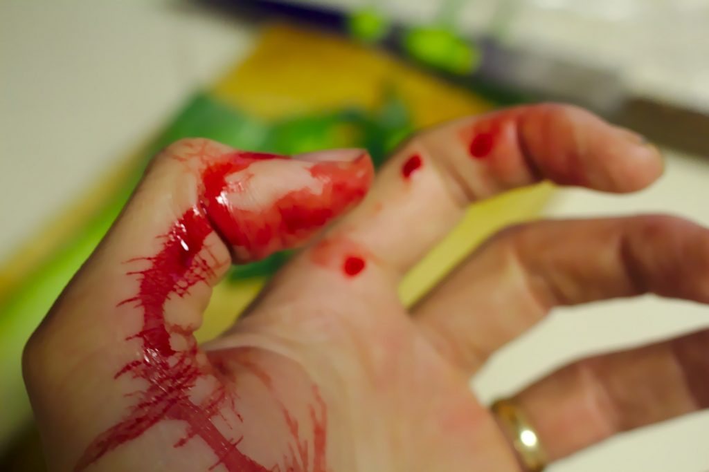 Sognare sangue macchie di sangue
