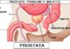 Postata malattie