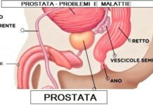Postata malattie