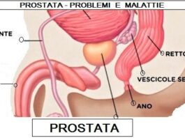 Postata malattie