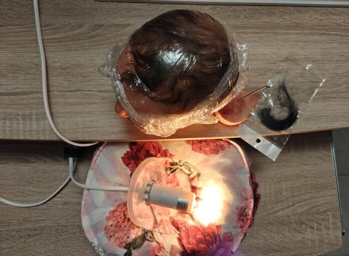 Rooting reborn l'importanza della lampada, ma non solo! Rooting reborn l'importanza della lampada, ma non solo!